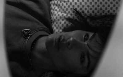 RF Skin Tightening vs. Botox